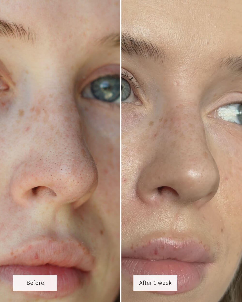 AQA™ Pore Clarifying Salicylic Acid Nose Strips