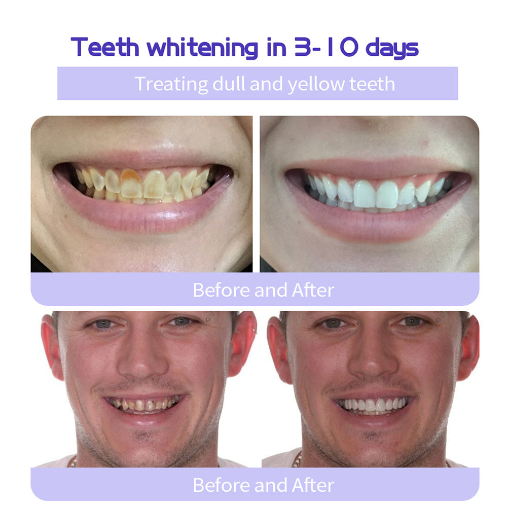 🔥Histone® Fluoride-Free Hydroxyapatite Enamel Repairing Breath Freshening Whitening Toothpaste