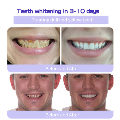 🔥Histone® Fluoride-Free Hydroxyapatite Enamel Repairing Breath Freshening Whitening Toothpaste