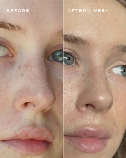 AQA™ Pore Clarifying Salicylic Acid Nose Strips